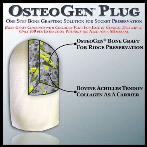 Osteogen Plugs
